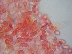  Leucoagaricus-littoralis-spore