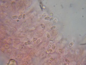 Pulverolepiota-pulverulentaspore